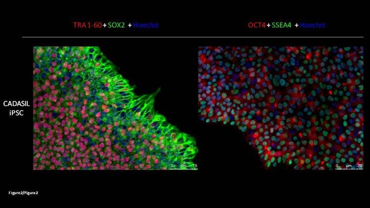 Líneas de investigación cadasil2